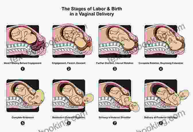 Labor And Delivery Process Why Did No One Tell Me This?: The Doulas (Honest) Guide For Expectant Parents