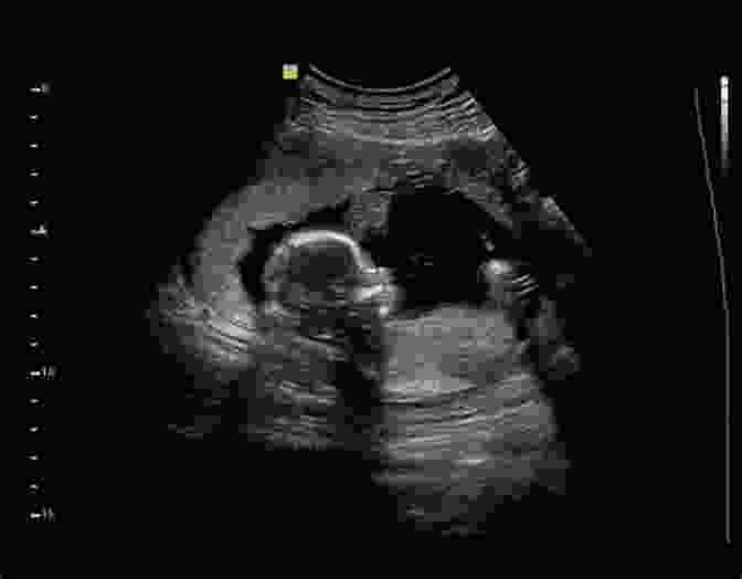 Ultrasound Image Of A Baby Why Did No One Tell Me This?: The Doulas (Honest) Guide For Expectant Parents