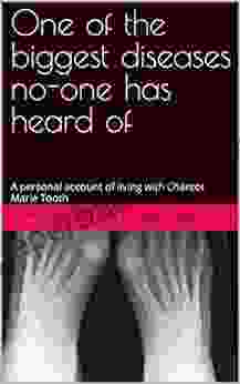 One Of The Biggest Diseases No One Has Heard Of: A Personal Account Of Living With Charcot Marie Tooth